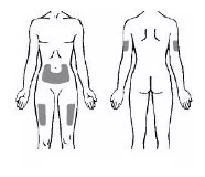 Disegni schematici del corpo umano che mostrano aree grigie sull'addome, sulle cosce, sulle braccia e sulla schiena per le iniezioni
