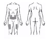 Diagramma del corpo umano che mostra aree grigie su addome, cosce e braccia per indicare i siti di applicazione del farmaco su fronte e retro