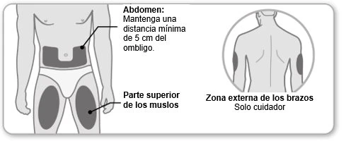 Medical diagram showing injection sites on the body