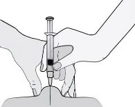 Two hands holding a syringe to inject the contents through the skin of the top of the head or skull