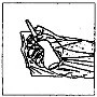 Disegno in bianco e nero che mostra una mano che impugna una siringa per effettuare un