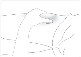 Line drawing of a hand pressing with the thumb on the skin of the