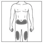 Schematic drawing of a male torso with gray highlighted areas on