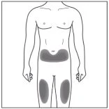 Schematic drawing of a male body with gray highlighted areas on the