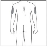 Schematic drawing of the human body viewed from the back, with two gray highlighted areas on the upper part of both arms