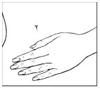Disegno lineare di una mano con dita distese che mostra una zona con piccoli puntini sulla parte superiore del dorso della mano
