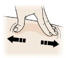 A hand pinches the skin with thumb and index finger while two black arrows indicate a lateral pulling motion towards the