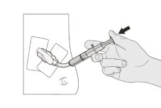 A hand holding a syringe tilted to inject the contents through two adhesive patches applied on the body's skin