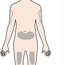 Frontal view diagram of the human body with gray areas indicating injection sites on the arms, on the