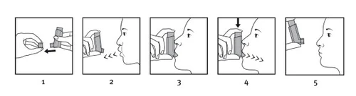Sequenza di cinque illustrazioni che mostrano come impugnare, posizionare e attivare il