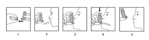 Sequenza di cinque illustrazioni che mostrano come assemblare il dispositivo
