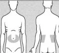 Diagramma di due figure umane che mostrano le aree di applicazione del farmaco sul corpo