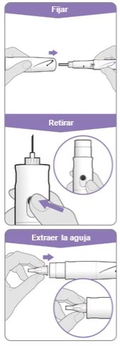 Three illustrations showing how to attach, retract, and finally remove the