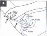 Disegno medico che mostra l