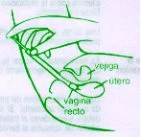 Green female anatomical diagram showing the position of the bladder, uterus, vagina, and rectum with schematic outline lines