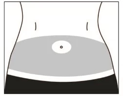 Schematic drawing of a human torso showing the