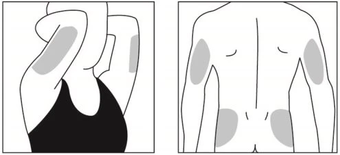 Schematic diagrams of the human body indicating the drug application sites on the arms and buttocks through shaded gray areas