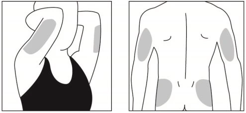 Schematic drawings of the human body indicating injection sites on the arms and buttocks in anterior and posterior views