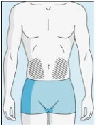 Schematic drawing of a male torso with two hatched areas on the lower part indicating application sites