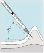 Diagram showing a syringe positioned at a 45-degree angle to the skin surface for subcutaneous injection