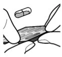 Disegno schematico che mostra una capsula farmaceutica che si dissolve sopra un tessuto muscolare striato tra dita che lo tengono fermo