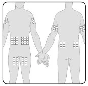 Diagramma del corpo umano frontale e posteriore con cerotti applicati su braccia, addome e cosce per indicare i siti di somministrazione del farmaco