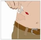 A hand holding a medical device against the skin of the