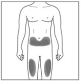 Schematic drawing of a male torso with three dark gray areas indicating injection sites on the body