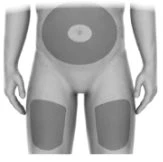 Human body diagram showing application areas highlighted in gray on the abdomen, thigh, and upper arm