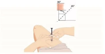 Diagram showing the correct angle for needle insertion during injection