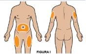 Diagramma di due corpi umani che mostra le zone di iniezione evidenziate in arancione sull