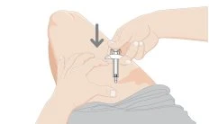 A hand pressing a medical device against the skin of a patient