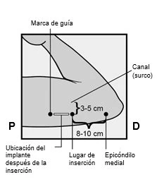 Medical diagram with guidelines for the