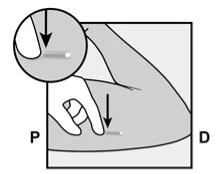 Technical drawing showing a hand pinching the skin of the thigh to prepare for the