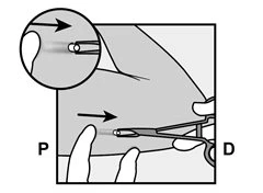 Medical diagram showing the