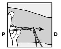 Diagram showing a hand holding a syringe with the