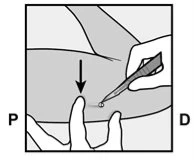 Technical drawing showing a hand holding an injection pen toward the thigh while a