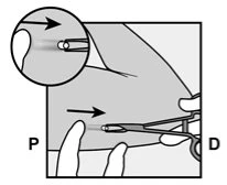 Medical diagram showing the