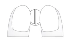 Disegno schematico in bianco e nero di una capsula farmaceutica divisa in due metà simmetriche con una linea verticale centrale
