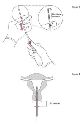 Diagramma medico che mostra due figure: la prima illustra come misurare una sonda con le mani, la seconda indica la profondità di inserimento di 1,5-2,0 cm