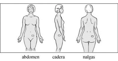 Three stylized drawings of a female figure showing the body from the front, side, and back, with highlighted areas on the abdomen, hip, and buttocks