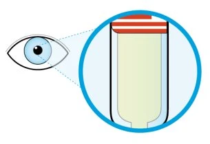 Diagramma che mostra un occhio umano che osserva un ingrandimento circolare di una fiala contenente un liquido chiaro con tappo rosso
