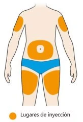 Diagramma del corpo umano con aree arancioni che indicano i siti di iniezione sulle braccia, sui glutei e sulle cosce