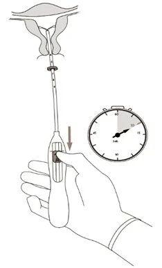Illustration of a hand pressing a medical device with a timer beside indicating application time in the vaginal area
