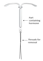 T-shaped medical device with hormone-containing compartment and thin removal threads on white background