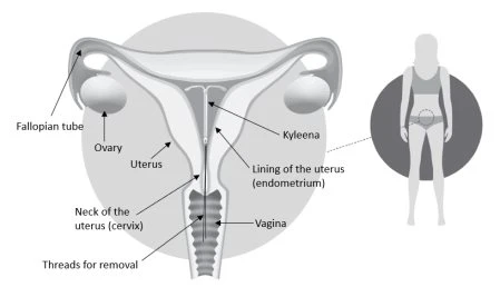 Female anatomical diagram showing the