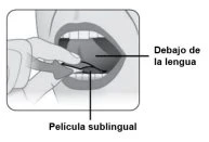 Illustrazione medica che mostra una mano che posiziona una pellicola sublinguale sotto la lingua di una persona aperta