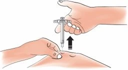 Una mano tiene una siringa con un ago rivolto verso la pelle mentre l'altra mano preme la zona del corpo con una freccia nera verso l'alto