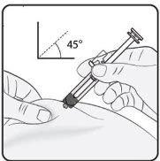 Una mano tiene una siringa inclinata a 45 gradi per iniettare il farmaco nella pelle del corpo con un diagramma angolare di riferimento