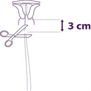 Medical diagram showing a pair of scissors cutting a small tube at a distance of 3 cm from the base of a funnel-shaped medical device